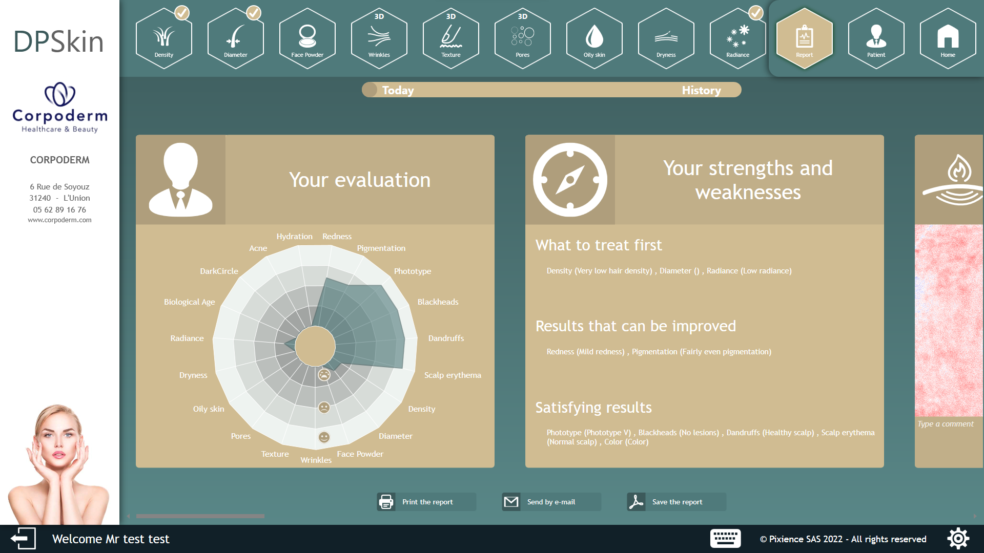 Analysis report